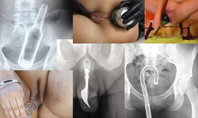 O que andámos a enfiar no rabo, no pénis e na vagina em 2024 